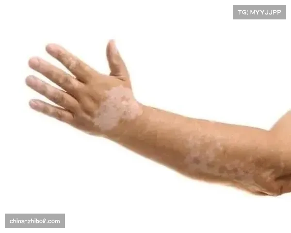 伤病专访:朱厄尔·罗伊德回顾康复历程,详解为恢复运动表现所做的数据追踪